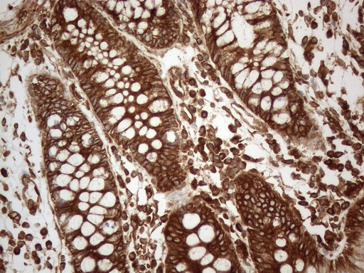 m05329 anti vapa mouse monoclonal antibody clone id oti10e10 ihc testing 13