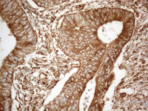 m05329 anti vapa mouse monoclonal antibody clone id oti10e10 ihc testing 14