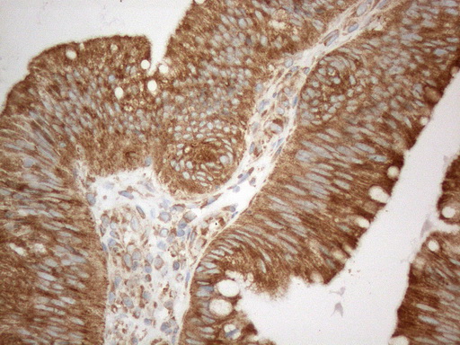 m05329 anti vapa mouse monoclonal antibody clone id oti10e10 ihc testing 5
