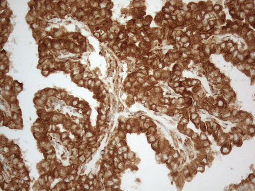 m05329 anti vapa mouse monoclonal antibody clone id oti10e10 ihc testing 7