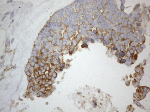 m05329 anti vapa mouse monoclonal antibody clone id oti10e10 ihc testing 8