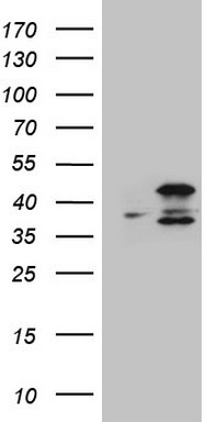 HEK293T cells were transfected with the pCMV6-ENTRY control (Left lane) or pCMV6-ENTRY VAPA (Right lane) cDNA for 48 hrs and lysed