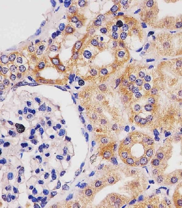 m05334 anti gls2 antibody ihc p testing 2