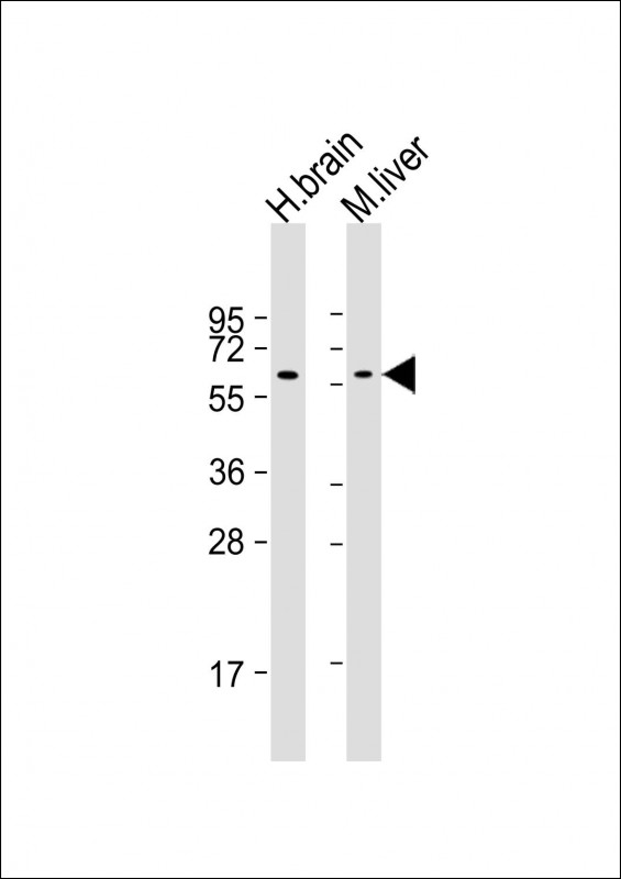 m05334 anti gls2 antibody wb testing 1