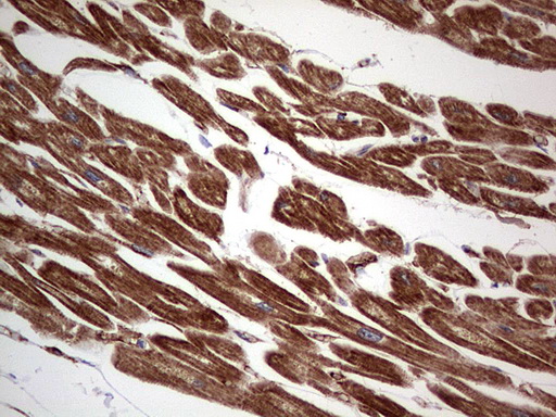 Immunohistochemical staining of paraffin-embedded Human adult heart tissue using anti-TACC2 mouse monoclonal antibody. (Heat-induced epitope retrieval by 1 mM EDTA in 10mM Tris