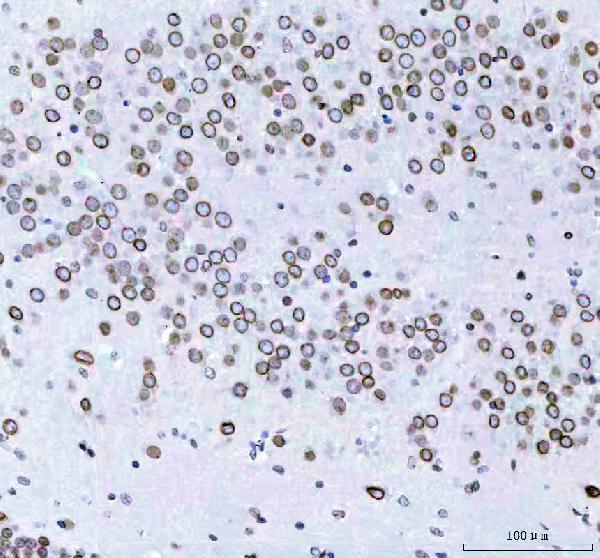 m05348 lmnb2 primary antibodies ihc testing 7