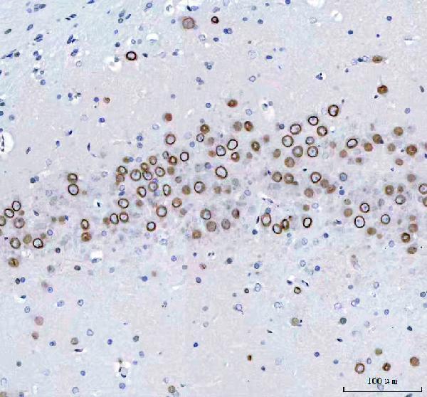 m05348 lmnb2 primary antibodies ihc testing 8
