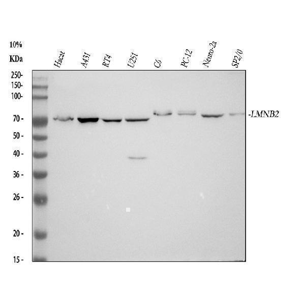  Western blot analysis of Lamin B2 using anti-Lamin B2 antibody (M05348)