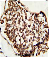 m05349 1 anti set07 antibody ihc p testing 3