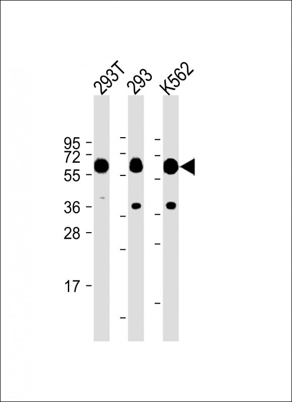 m05349 1 anti set07 antibody wb testing 1