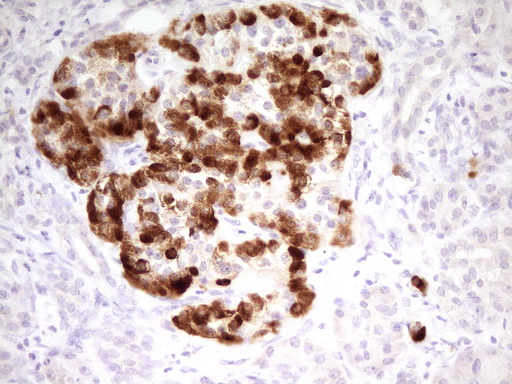 m05355 anti mark3 mouse monoclonal antibody clone id oti2g8 ihc testing 3