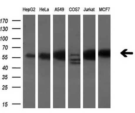 Western blot analysis of extracts (10ug) from 6 different cell lines by using anti-ANXA11 monoclonal antibody (1:200)