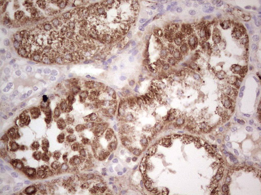 Immunohistochemical staining of paraffin-embedded Human Kidney tissue within the normal limits using anti-RSPO3 mouse monoclonal antibody