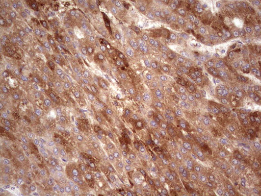 m05387 1 anti rspo3 mouse monoclonal antibody clone id oti3a9 ihc testing 5