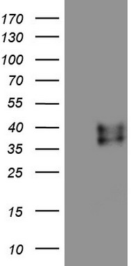 HEK293T cells were transfected with the pCMV6-ENTRY control (Left lane) or pCMV6-ENTRY RSPO3 (Right lane) cDNA for 48 hrs and lysed