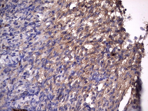 Immunohistochemical staining of paraffin-embedded Human Ovary tissue within the normal limits using anti-RSPO3 mouse monoclonal antibody