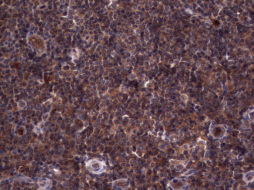 m05387 anti rspo3 mouse monoclonal antibody clone id oti3d5 ihc testing 10