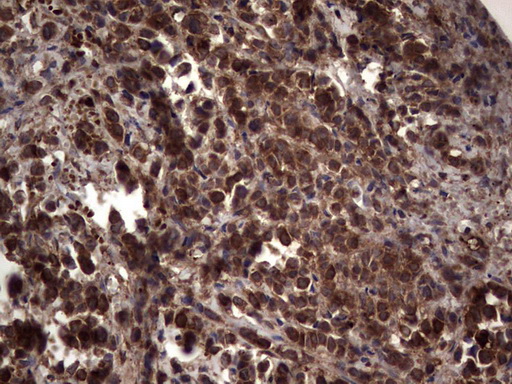 m05387 anti rspo3 mouse monoclonal antibody clone id oti3d5 ihc testing 11