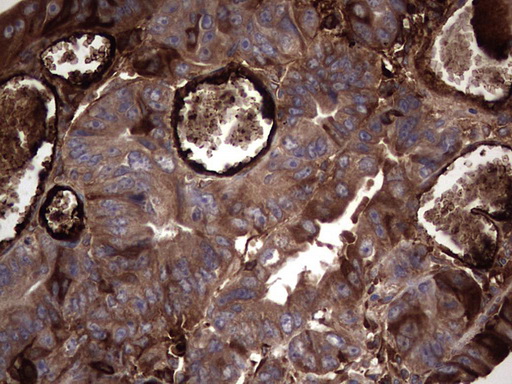 m05387 anti rspo3 mouse monoclonal antibody clone id oti3d5 ihc testing 12