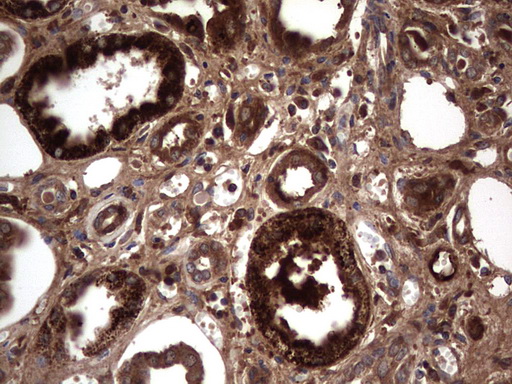 m05387 anti rspo3 mouse monoclonal antibody clone id oti3d5 ihc testing 13