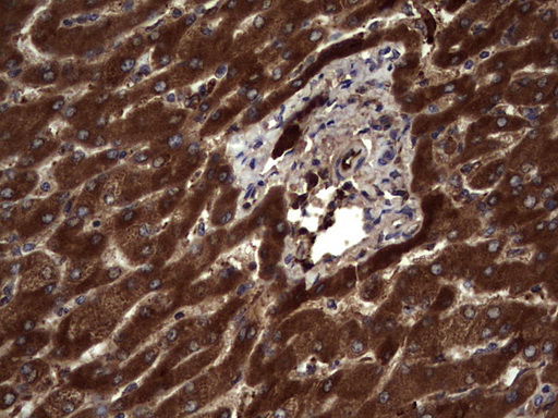 m05387 anti rspo3 mouse monoclonal antibody clone id oti3d5 ihc testing 14