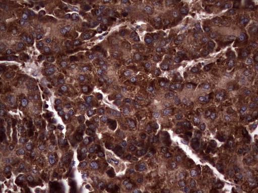 m05387 anti rspo3 mouse monoclonal antibody clone id oti3d5 ihc testing 15
