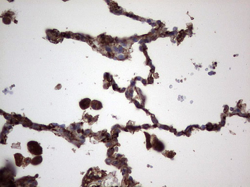 m05387 anti rspo3 mouse monoclonal antibody clone id oti3d5 ihc testing 16