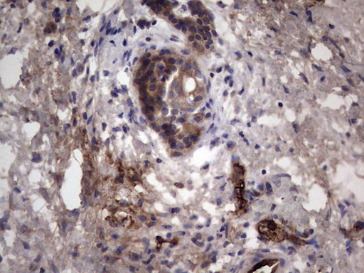 m05387 anti rspo3 mouse monoclonal antibody clone id oti3d5 ihc testing 4