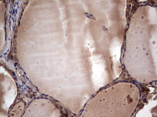 m05387 anti rspo3 mouse monoclonal antibody clone id oti3d5 ihc testing 5