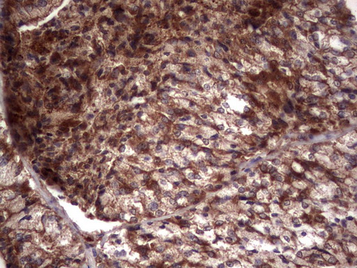 m05387 anti rspo3 mouse monoclonal antibody clone id oti3d5 ihc testing 6