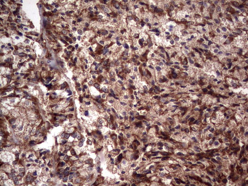 m05387 anti rspo3 mouse monoclonal antibody clone id oti3d5 ihc testing 7