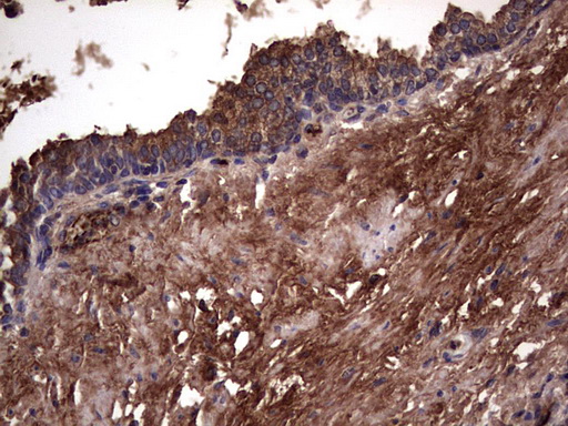 m05387 anti rspo3 mouse monoclonal antibody clone id oti3d5 ihc testing 8