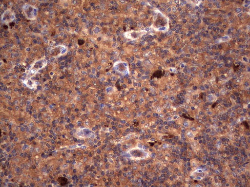 m05387 anti rspo3 mouse monoclonal antibody clone id oti3d5 ihc testing 9