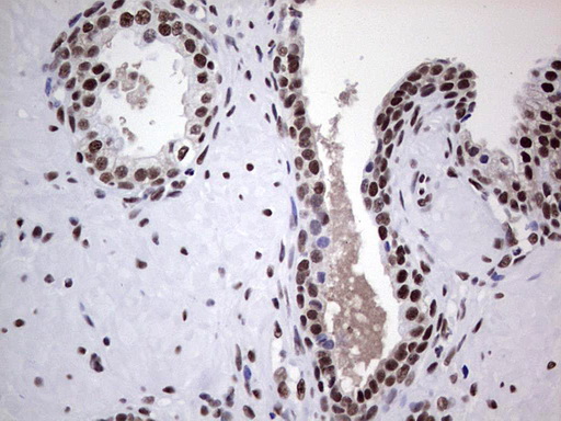 m05396 anti nipp1 ppp1r8 mouse monoclonal antibody clone id oti4e5 ihc testing 10