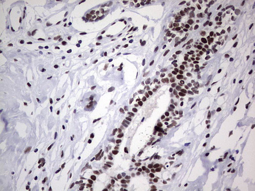 m05396 anti nipp1 ppp1r8 mouse monoclonal antibody clone id oti4e5 ihc testing 11