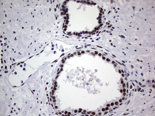 m05396 anti nipp1 ppp1r8 mouse monoclonal antibody clone id oti4e5 ihc testing 12