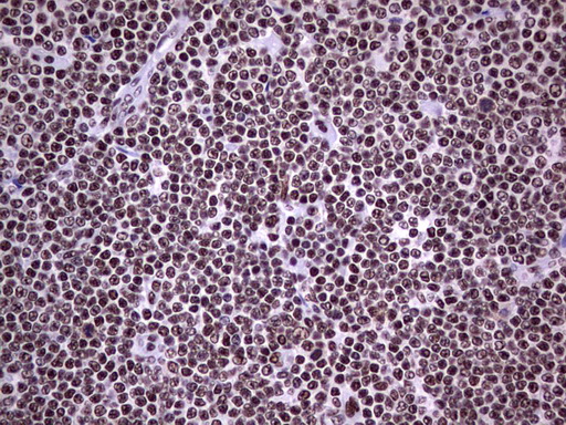 m05396 anti nipp1 ppp1r8 mouse monoclonal antibody clone id oti4e5 ihc testing 13