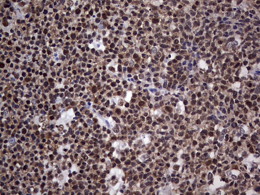 m05396 anti nipp1 ppp1r8 mouse monoclonal antibody clone id oti4e5 ihc testing 14