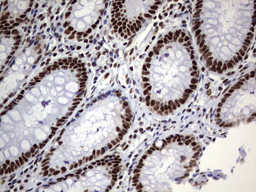 m05396 anti nipp1 ppp1r8 mouse monoclonal antibody clone id oti4e5 ihc testing 15
