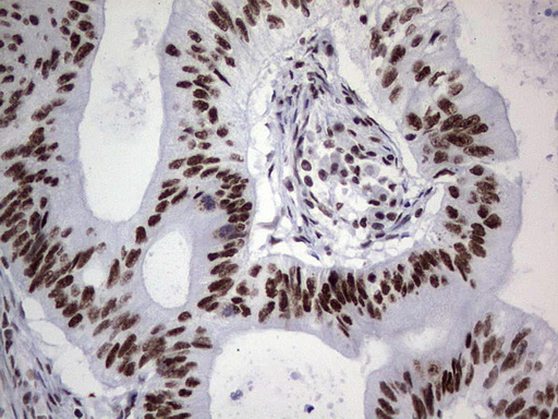 m05396 anti nipp1 ppp1r8 mouse monoclonal antibody clone id oti4e5 ihc testing 16