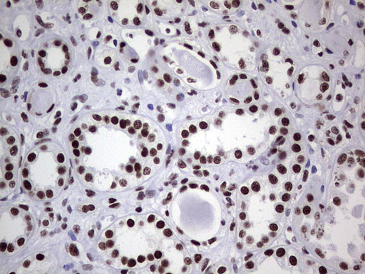 m05396 anti nipp1 ppp1r8 mouse monoclonal antibody clone id oti4e5 ihc testing 17
