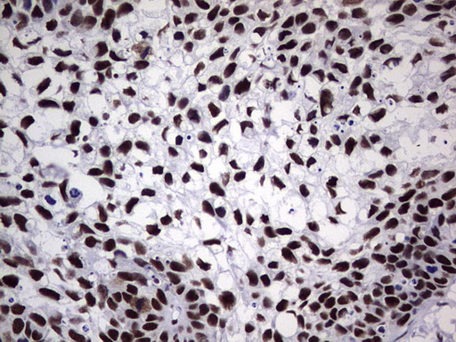 m05396 anti nipp1 ppp1r8 mouse monoclonal antibody clone id oti4e5 ihc testing 18