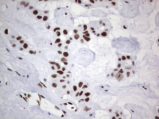 m05396 anti nipp1 ppp1r8 mouse monoclonal antibody clone id oti4e5 ihc testing 19