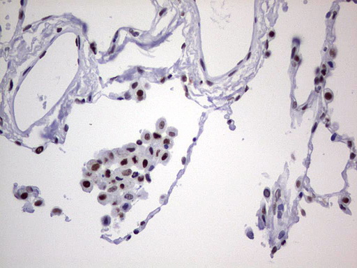 m05396 anti nipp1 ppp1r8 mouse monoclonal antibody clone id oti4e5 ihc testing 20