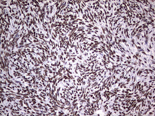 Immunohistochemical staining of paraffin-embedded Human Ovary tissue within the normal limits using anti-PPP1R8 mouse monoclonal antibody
