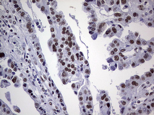 m05396 anti nipp1 ppp1r8 mouse monoclonal antibody clone id oti4e5 ihc testing 4