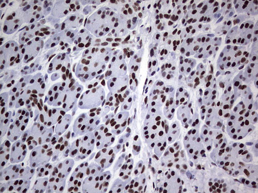 m05396 anti nipp1 ppp1r8 mouse monoclonal antibody clone id oti4e5 ihc testing 5