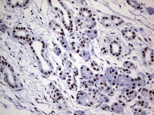 m05396 anti nipp1 ppp1r8 mouse monoclonal antibody clone id oti4e5 ihc testing 6