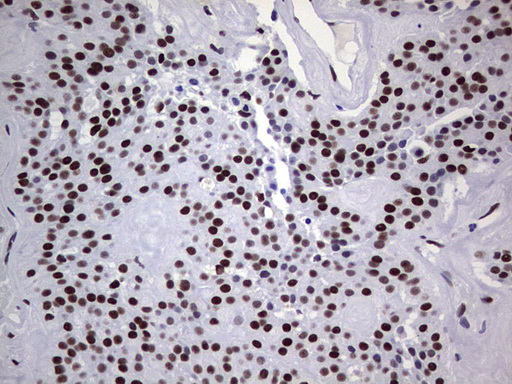 m05396 anti nipp1 ppp1r8 mouse monoclonal antibody clone id oti4e5 ihc testing 7