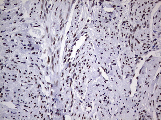 m05396 anti nipp1 ppp1r8 mouse monoclonal antibody clone id oti4e5 ihc testing 8